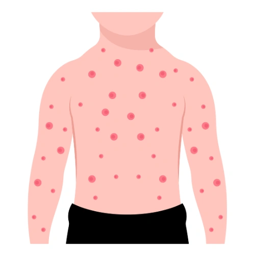 Allergy Conferences